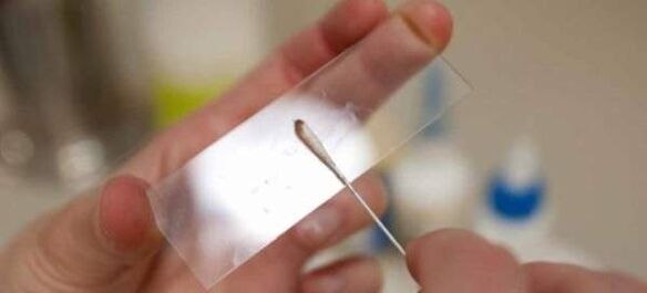 Ξύσιμο για αυγά σκουληκιών